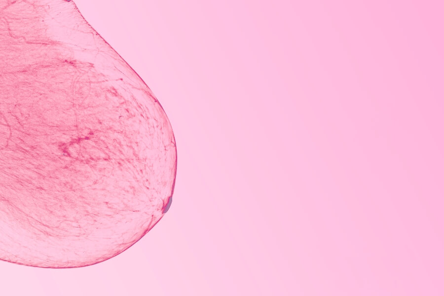 what is a 3D mammogram