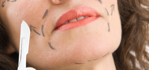 Cost of a Facelift: What REALLY Happens When You Go Under the Knife